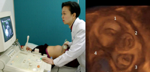 Người phụ nữ đau bụng bất thường, bác sĩ siêu âm và nghe thấy có 5 tim thai