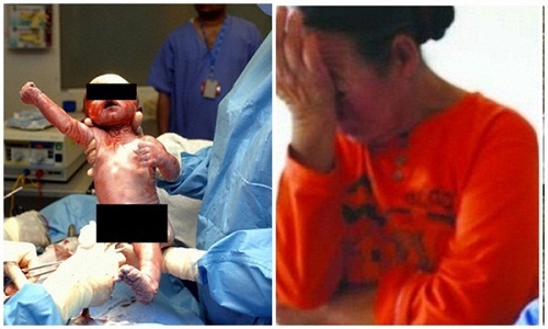 Con dâu khó sinh và quyết định đầy bất ngờ của mẹ chồng