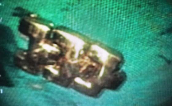 Nuốt dây đồng hồ kim loại, bé gái 3 tuổi suýt tử vong