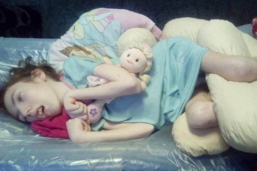 Bé gái tật nguyền suốt đời chỉ vì nụ hôn đầu tiên của người mẹ