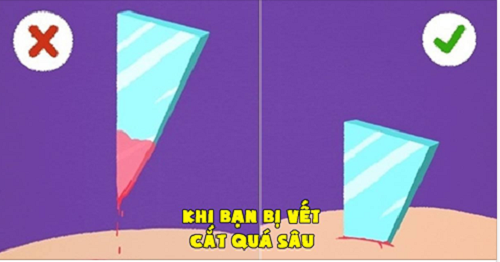 5 kỹ năng sinh tồn giúp bạn thoát khỏi cái chết trong gang tấc