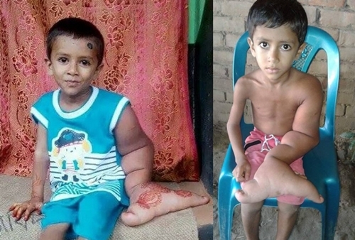 Kinh hoàng vì bàn tay to kì dị, dân làng xa lánh