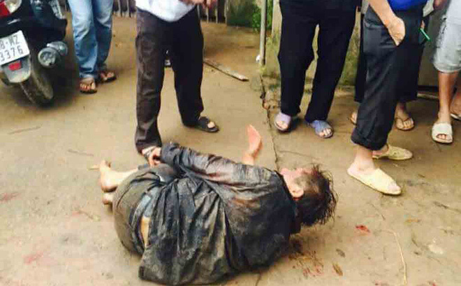 Câu trộm 4 con chó, 1 