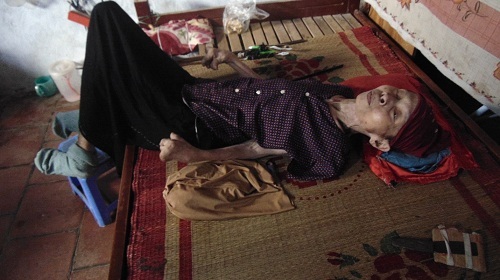 Câu chuyện về người phụ nữ bại liệt 42 năm và người con gái hiếu thảo