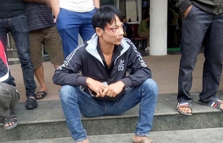 Sự thật vụ người nhà bệnh nhân xin vào thăm bị bảo vệ đánh chảy máu đầu