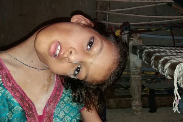 Cô bé 9 tuổi Pakistan sống trong đau đớn với chiếc cổ vẹo 90 độ