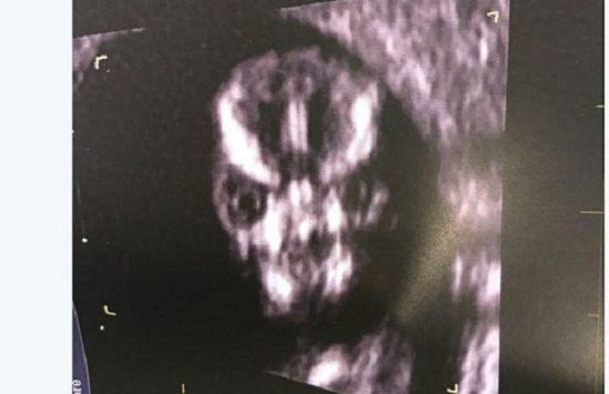 Khoe bức ảnh siêu âm thai nhi kỳ lạ, người mẹ khiến nhiều người ngạc nhiên