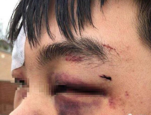 Du học sinh Trung Quốc bị đánh vì không cho thuốc lá