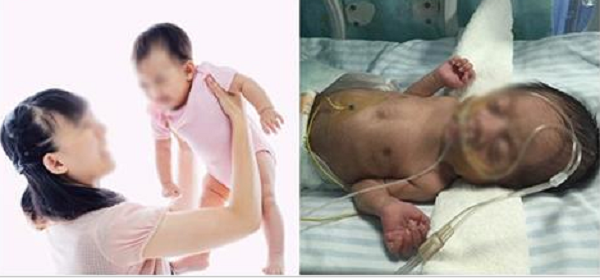 Mối nguy hại ẩn chứa khi bố mẹ đung đưa, rung lắc khi trẻ sơ sinh khóc