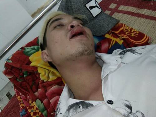 Vụ CSGT bị tố đánh người: Công an tỉnh Đắk Nông lên tiếng