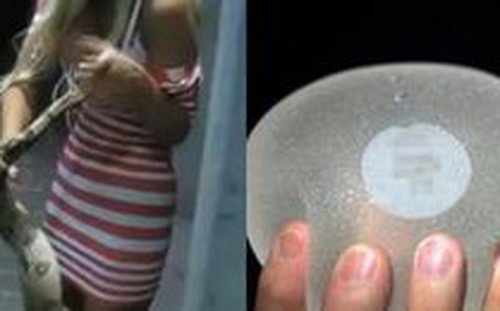 Cắn vào ngực cô gái trẻ, con rắn lăn ra chết vì… trúng độc chất silicon