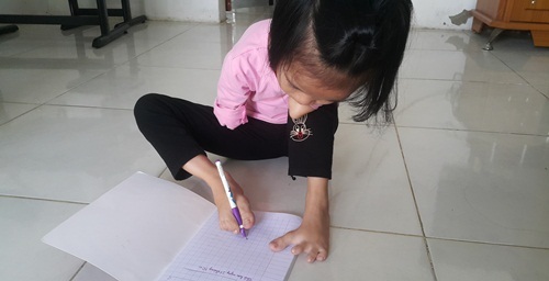 Xót xa khi nghe con hỏi: “Mẹ ơi, tay con đâu?”