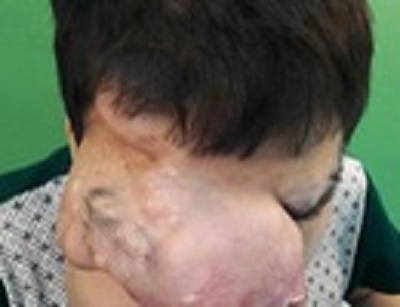 11 chuyên khoa phối hợp, phẫu thuật cho bệnh nhân 