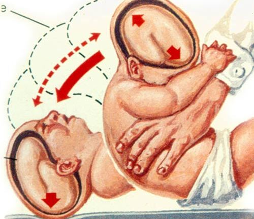 Não bộ của trẻ bị ảnh hưởng như thế nào nếu bị rung lắc?