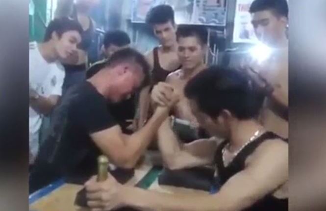 Quá mong chiến thắng, thanh niên bị gãy xương khi chơi trò vật tay
