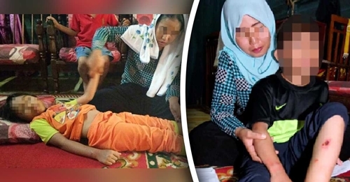 Phẫn nộ với ông bố dí thuốc lá, rạch dao vào người con gái 8 tuổi vì ... giống vợ cũ