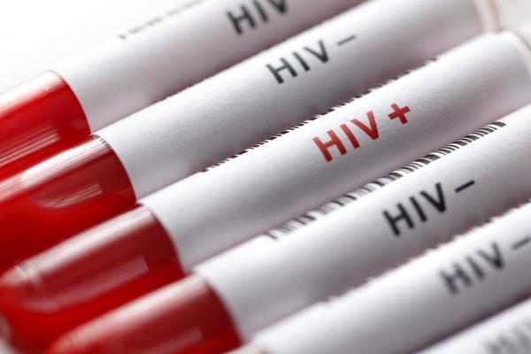 Nhiều công dân Nga nghĩ virus HIV/AIDS là trò bịp bợm của truyền thông Phương Tây
