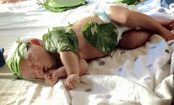 Bé 6 tháng tuổi bị bỏng nặng vì đắp lá trầu không trị khò khè