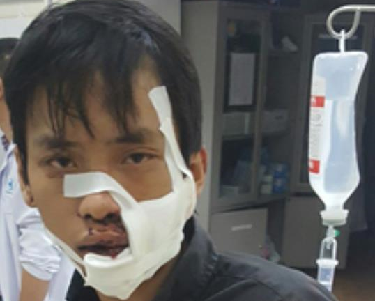 Điều tra vụ 2 nhóm thanh niên cầm mã tấu chém nhau, 5 người bị thương