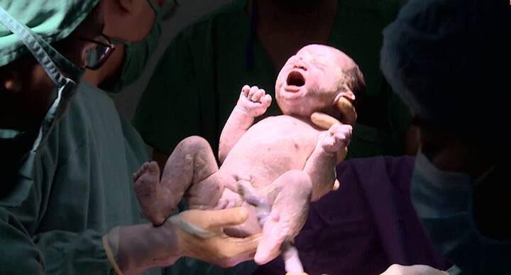 Em bé thụ tinh ống nghiệm đầu tiên tại Quảng Ninh chào đời