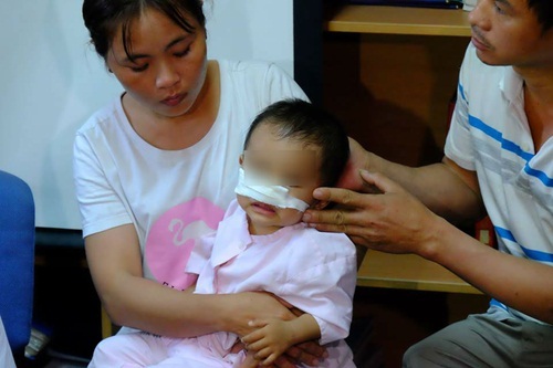 Bé trai 1 tuổi bị chó nhà nuôi cắn rách mặt, mất mũi