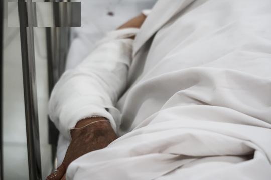 Ghen tuông, người phụ nữ tạt axit chồng rồi đi đầu thú