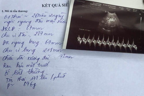 Sản phụ tai nạn giao thông thai chết lưu, người nhà tố bệnh viện tắc trách