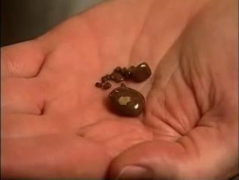 Mất thận vì tự ý detox theo 'bác Google'