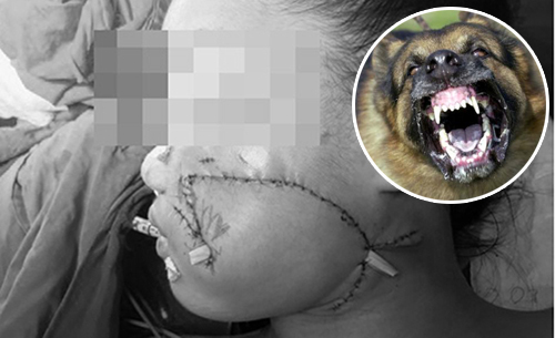 Chó mèo cắn, đừng chủ quan!