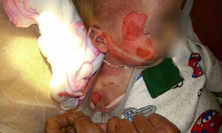 Bé 15 tháng tuổi tử vong với nhiều vết thương 'lạ', gia đình nói lỗi tại bệnh viện