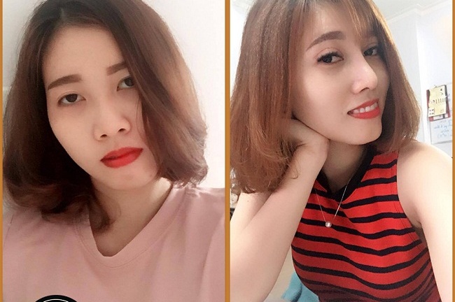 Đừng nâng mũi S line, bạn sẽ “lột xác” đó!