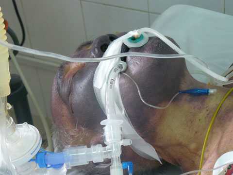 Bệnh chết người ẩn trong lợn nuôi dân dã được cho là lợn “sạch” 