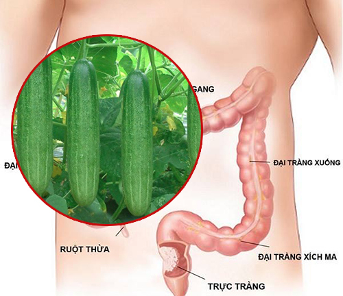 Nam bệnh nhân suýt mất mạng khi bị dưa chuột
