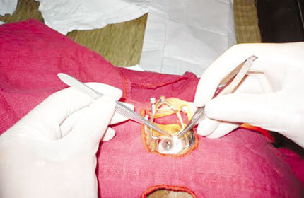 Bé 7 tuổi ở Hà Nội hiến giác mạc gây xúc động