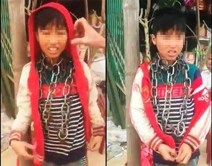 Cháu bé bị khóa dây xích quanh cổ: Tiết lộ câu chuyện thương tâm