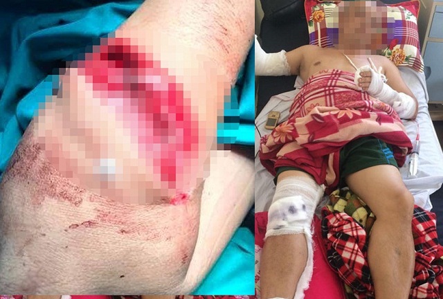 Điều tra vụ bị chém bằng kiếm trong đêm khi đang thanh toán tiền