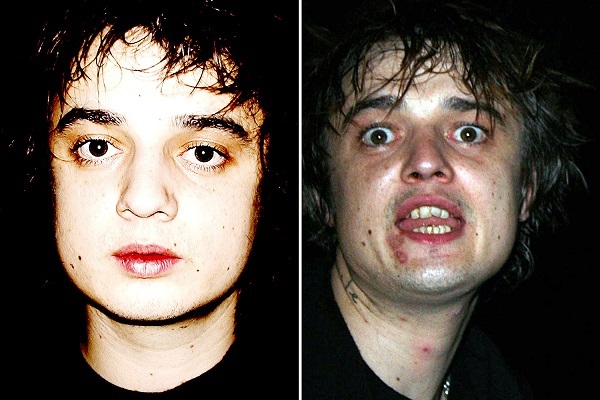 Chùm ánh những ngôi sao thế giới từng điêu đứng vì 