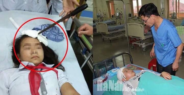 Vụ nữ sinh bị bạn phi dao trúng trán: Bộ GD&ĐT chỉ đạo 'nóng'