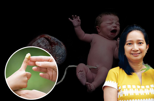 Mọc lại đốt ngón tay nhờ… sữa mẹ: Đừng để “tà phái” lên ngôi!