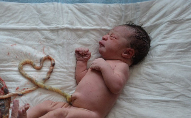 Sinh con “thuận theo tự nhiên” tại nhà: Nguy cơ vỡ tử cung, cả mẹ và con đều tử vong