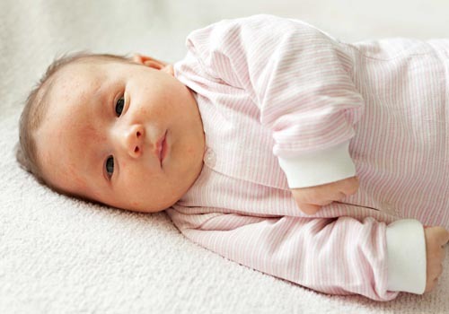 Chăm sóc trẻ bị rôm sảy, mẩn ngứa khi vào hè