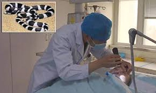 Khách trọ bị rắn độc cắn hôn mê tại khách sạn