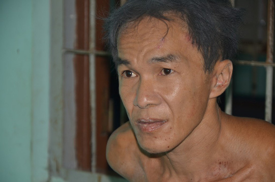 Bắt khẩn cấp nghi phạm chặt đầu nạn nhân, chém công an đứt lìa ngón tay