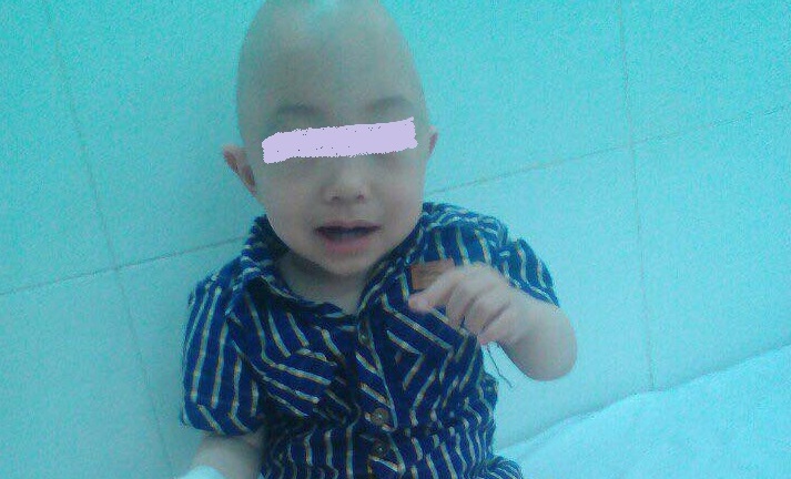 Phẫu thuật thành công hộp sọ dị dạng bẩm sinh hiếm gặp cho bé 21 tháng tuổi