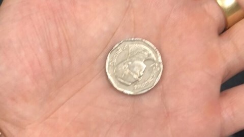 Bé trai 6 tuổi khó thở nhập viện cấp cứu do nuốt đồng xu