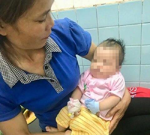 Bé trai 2 tháng tuổi bị chó cắn khi đang ngủ say trên võng