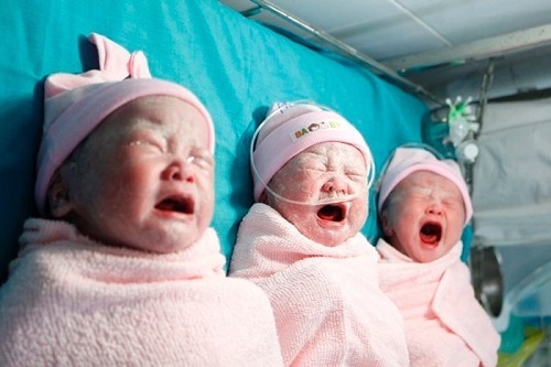 Phẫu thuật thành công cho trường hợp sản phụ mang tam thai có vết mổ cũ