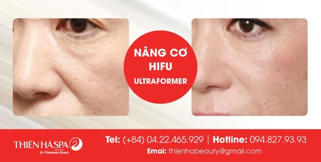 Thiên Hà Spa – Làm đẹp mà không cần phẫu thuật