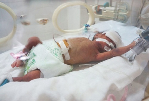 Bình Thuận: Bé trai sơ sinh bị chôn sống được cứu kịp thời