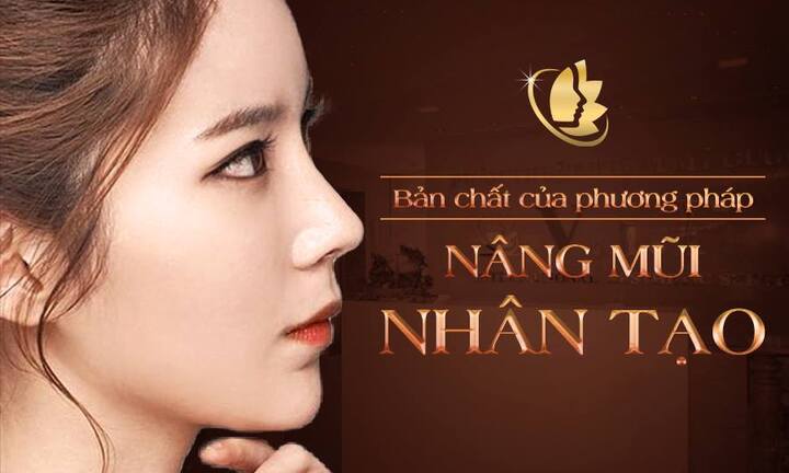 Nâng mũi bằng sụn nhân tạo dưới góc nhìn của chuyên gia